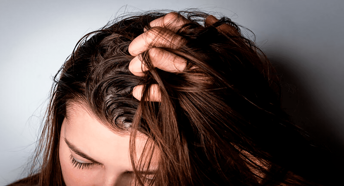 mujer enseñando su cabello muy graso