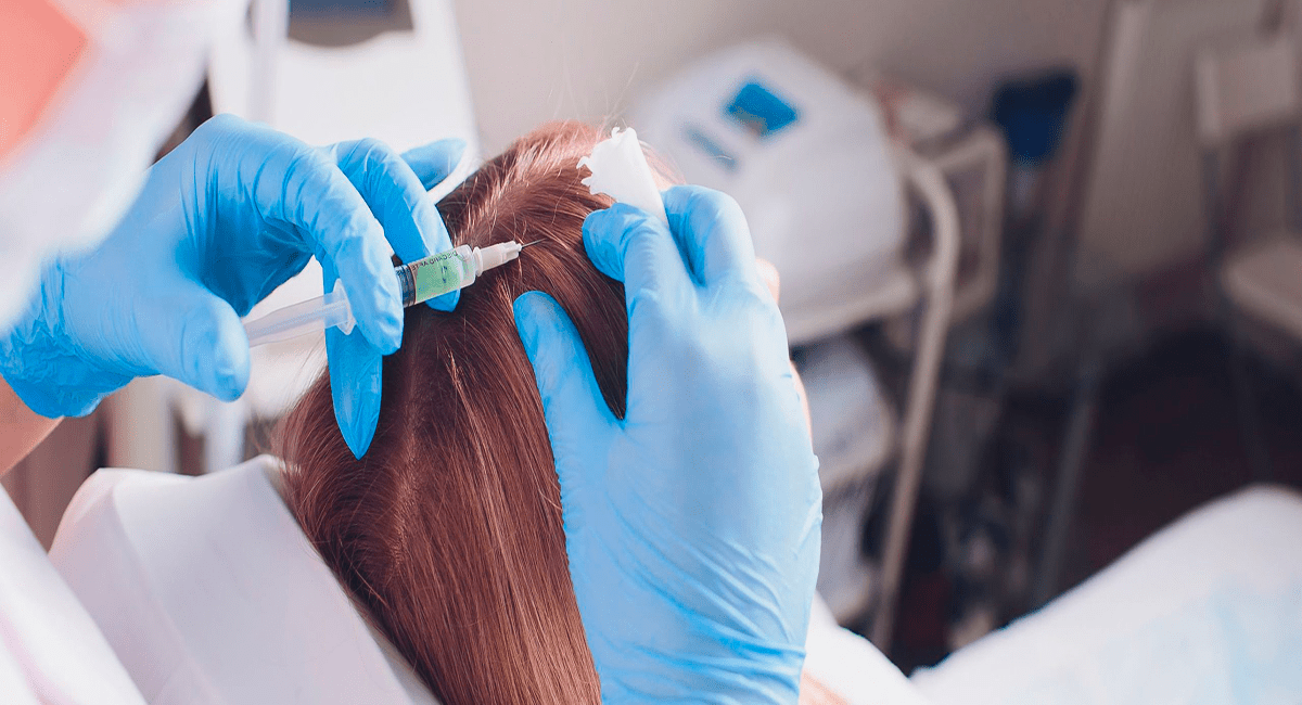 Imagen de tratamientos capilares en IMD - Instituto Médico Dermatológico