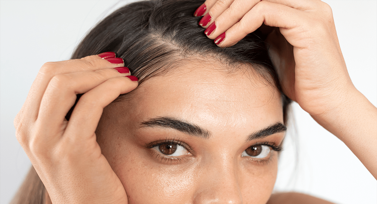 Mujer enseñando su alopecia en el cuero cabelludo